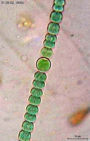 Anabaena_sperica2